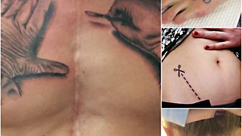 14 scars turn into cool tattoos