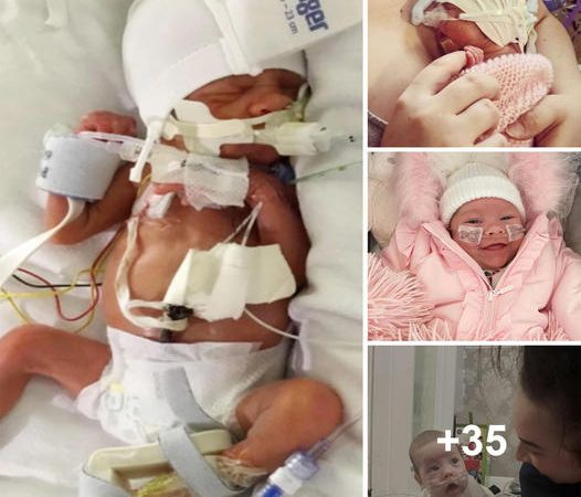 Medical Miracle: Twins Born Prematurely at 23 Weeks Set World Record for Survival
